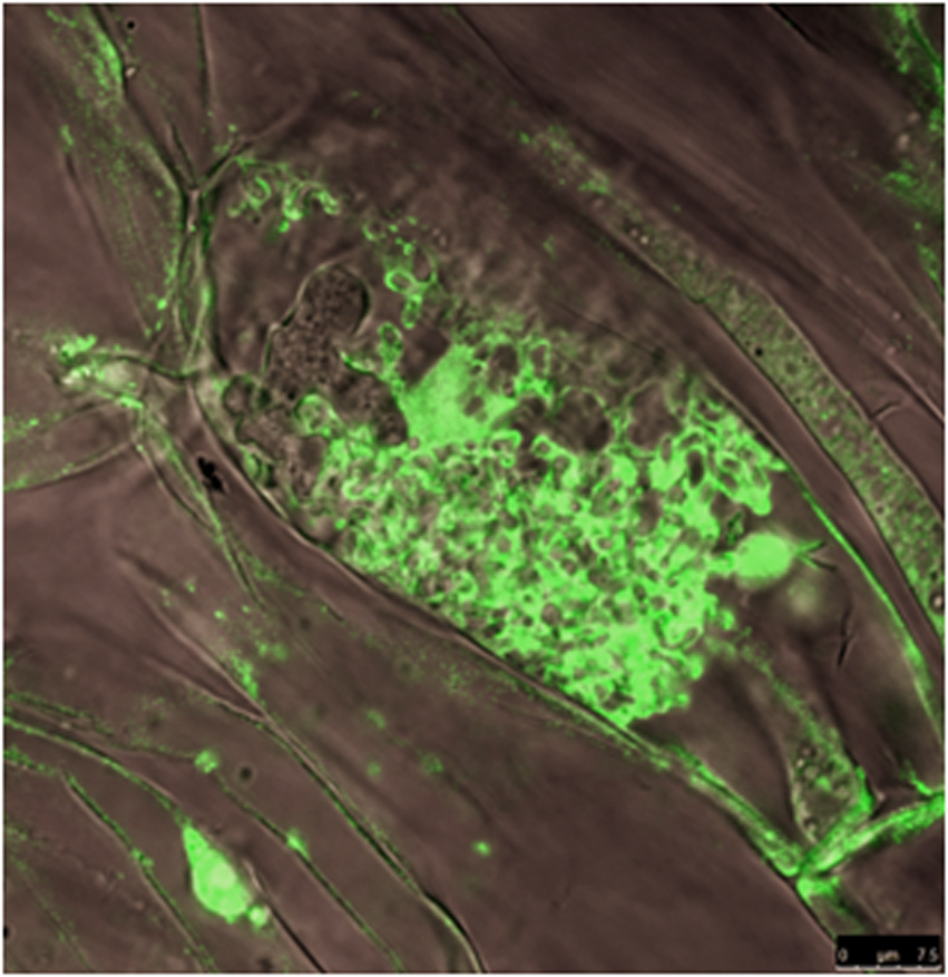 Конфокальная микроскопия. Клетка корня люцерны, содержащая арбускулярную микорризу.
